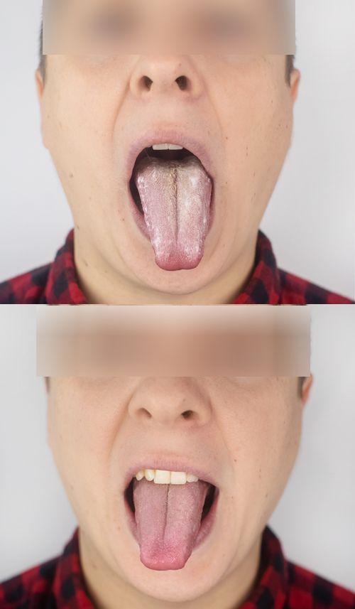 澳门研究生最新资料和舌根和牙龈被缝一起与舌根和牙龈被缝一起怎么办