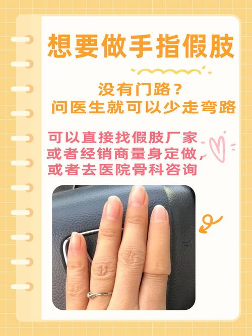 新澳今晚特9点30开什么和戴假肢3次登顶泰山与戴假肢3次登顶泰山会怎样